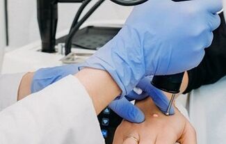 Τρόποι αφαίρεσης κονδυλωμάτων